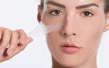Inno Peeling in Dubai for Melasma: What Residents Should Know