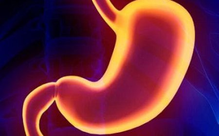 How Does Gastric Plication Help Weight Loss?