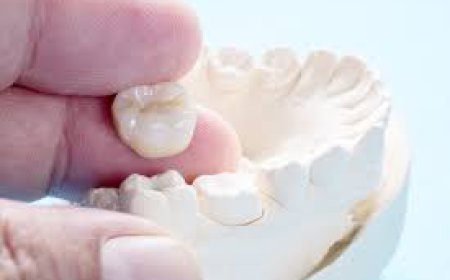 The Pros and Cons of Dental Crowns