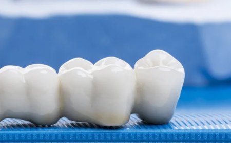 Dental Bridge Services in Bloomingdale - Eagle Falls