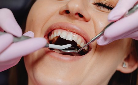 Turkey Teeth Makeover Cost and Results Guide for a Perfect Smile