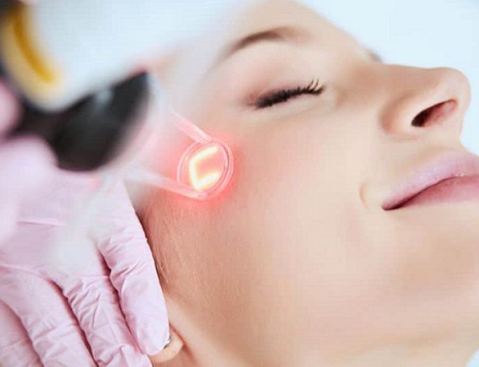 الليزر الجزئي في الرياض لعلاج فرط التصبغ: ما الذي يجب أن تعرفه