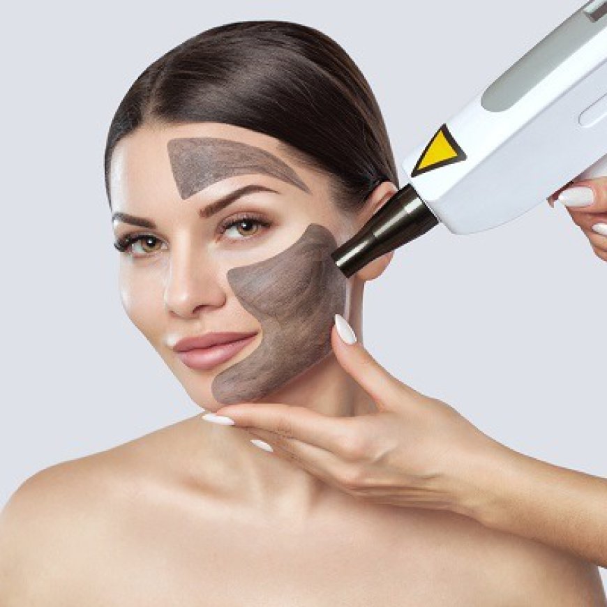 What Is the Average Cost of a Laser Carbon Peel?