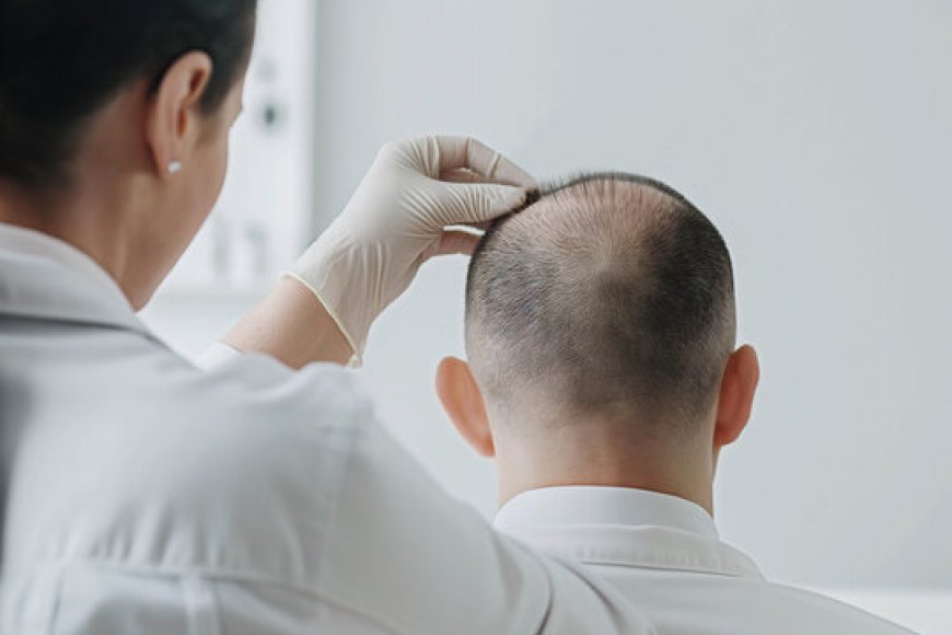 How Safe Are Crown Hair Transplants for Men and Women?