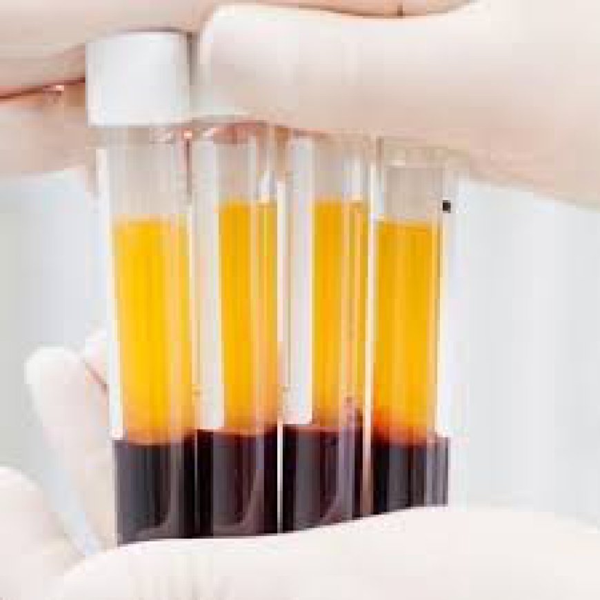 How Does Concentrated Growth Factor Therapy Function?