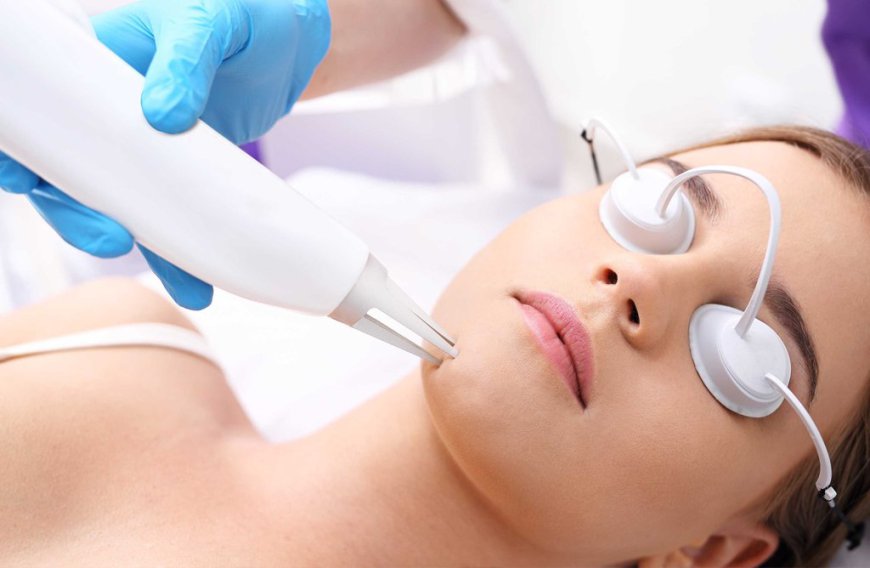 How Do Laser Treatments Work on the Skin?