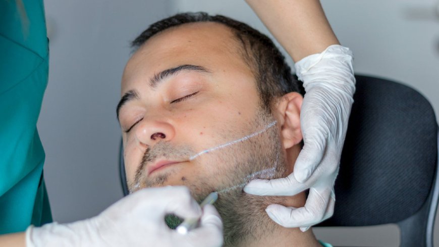 Can Men Benefit From Jawline Fillers?