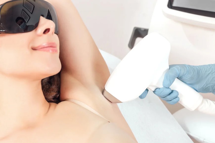 Is Laser Hair Removal Fda-approved?