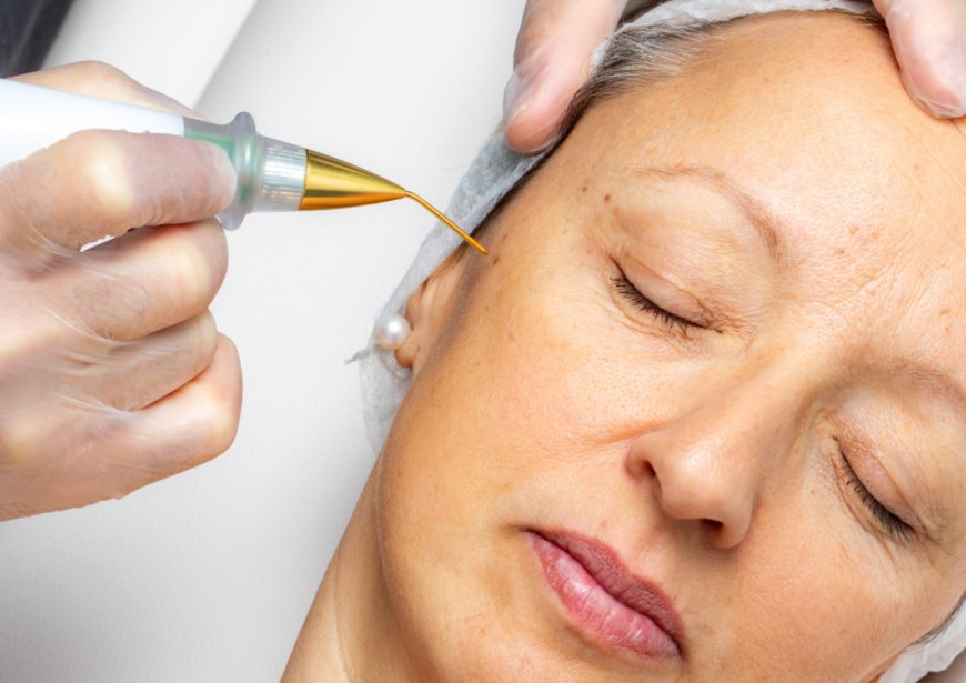 How Does Plasma Pen Treatment Work?