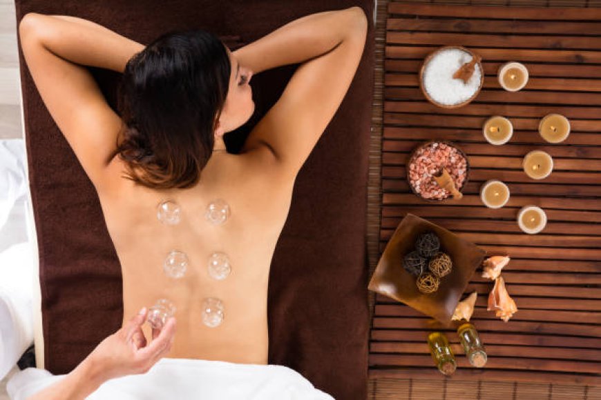 Cupping Therapy in Dubai: A Complete Guide to Hijama & Wellness