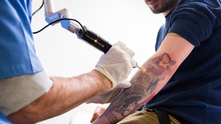 How Does PicoSure Remove Tattoos Effectively?