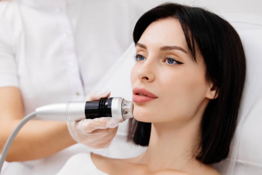 Fractional RF Microneedling for "Tech Neck" and Neck Rejuvenation