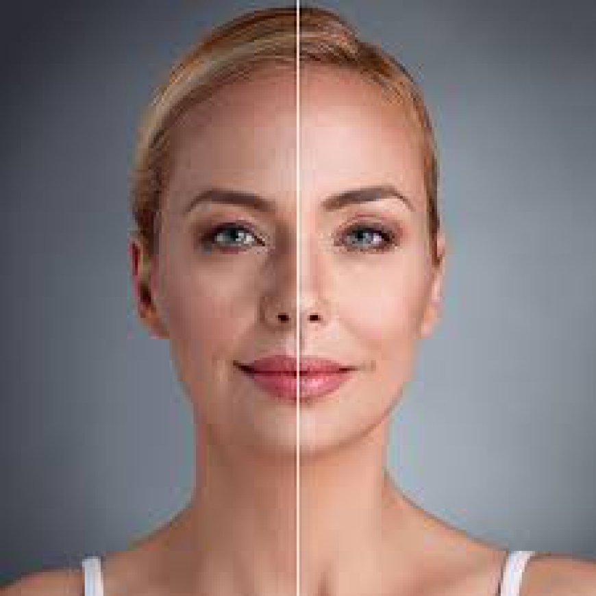 Deep Plane Facelift vs. Traditional Options: What Blue Angel Poly Clinic Won’t Dress Up