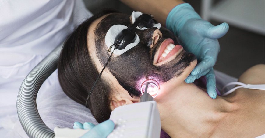 What Is a Spectra Carbon Peel and How Does It Work?