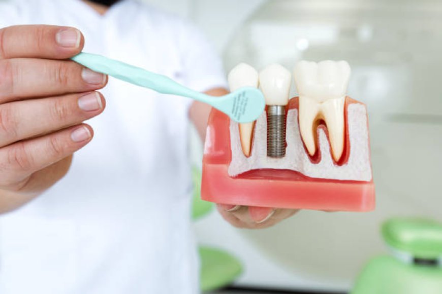 Dental Implants Caldwell Patients Trust For Lasting Confident Smiles