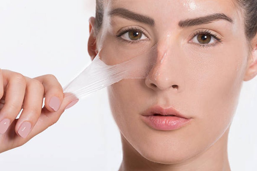 Inno Peeling in Dubai for Melasma: What Residents Should Know