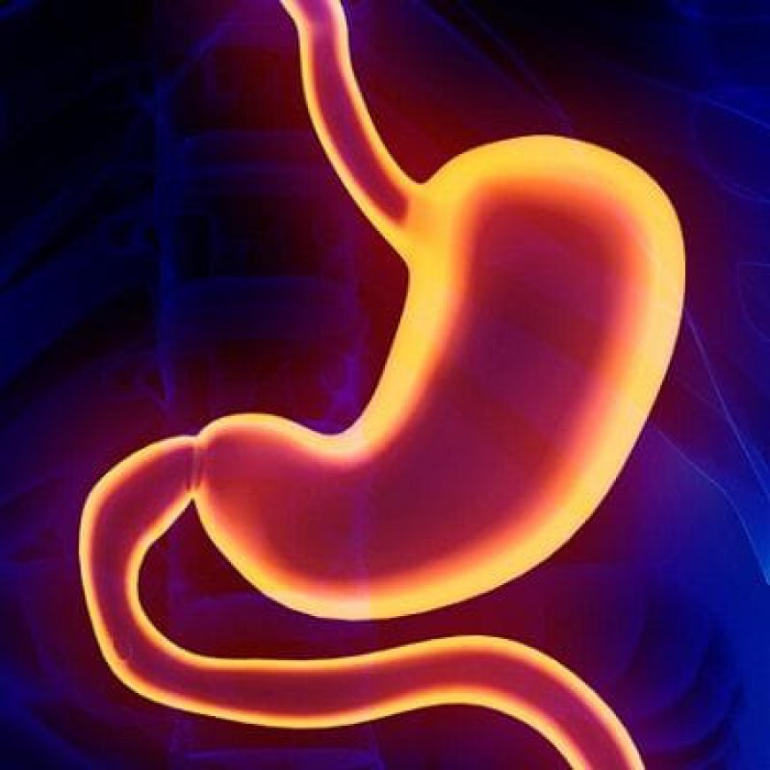 How Does Gastric Plication Help Weight Loss?