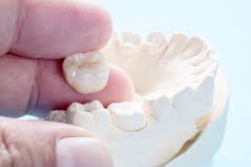 The Pros and Cons of Dental Crowns