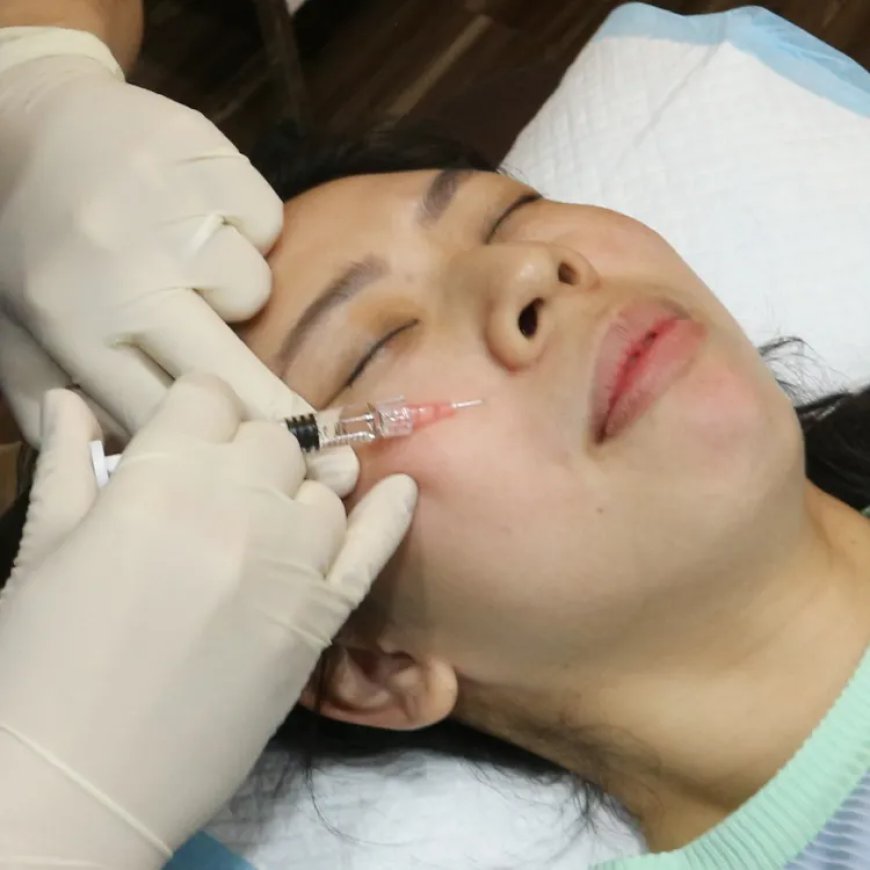 How Does Rejuran Treatment Improve the Skin?