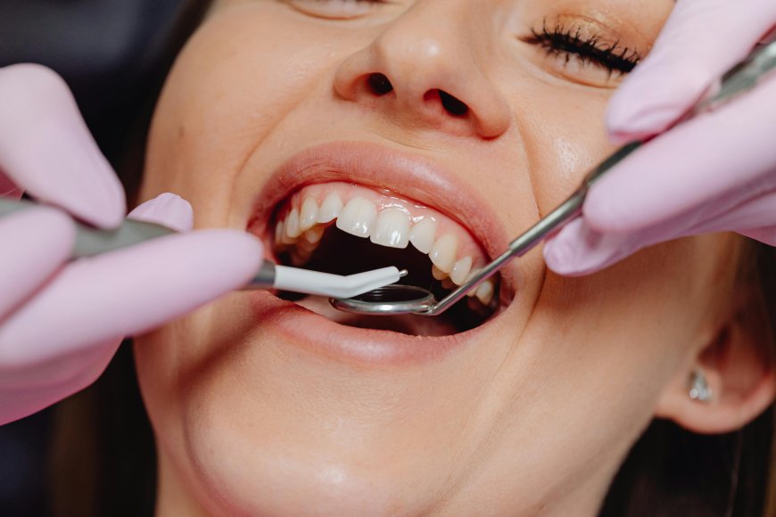 Turkey Teeth Makeover Cost and Results Guide for a Perfect Smile