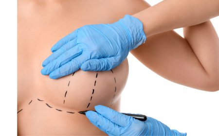 What Is a Breast Lift Procedure and How Is It Performed?