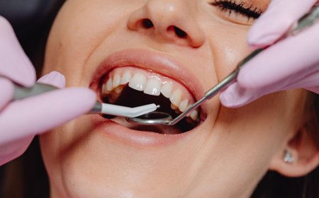Emergency Dentist in Macquarie Park for Urgent Dental Treatment