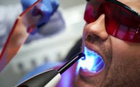 The Smarter Way to Visit the Dentist: How Laser Dentistry Is Changing Oral Care in Dubai