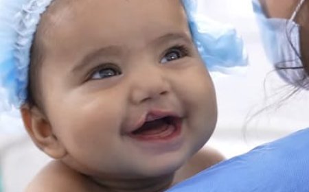 What Is Palate Repair Surgery and How Is It Done?