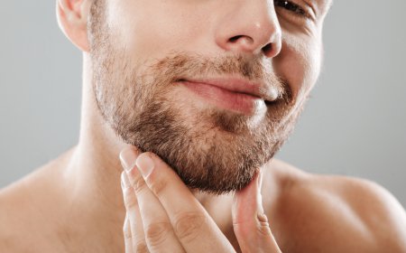 Who Is a Good Candidate for a Beard Hair Transplant?