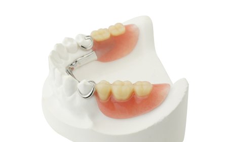 Who Can Benefit Most from Dentures?