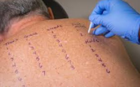 Before You Try Another Allergy Medication, Read This Guide to Allergy Testing Near Me