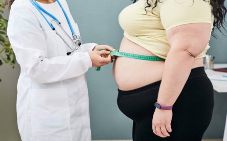 How to Choose the Best Obesity Treatment Dubai Program for Your Needs