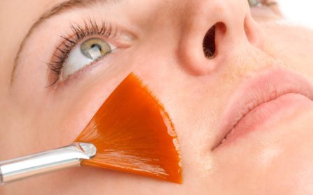How Does a Salicylic Acid Peel Benefit the Skin?