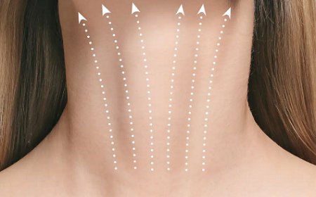 How Is Neck Lift Surgery Performed?