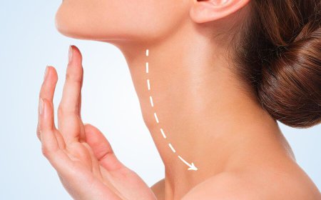 Who Is an Ideal Candidate for Neck Lift Surgery?