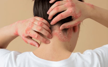 Can Skin Conditions Be Treated Successfully?