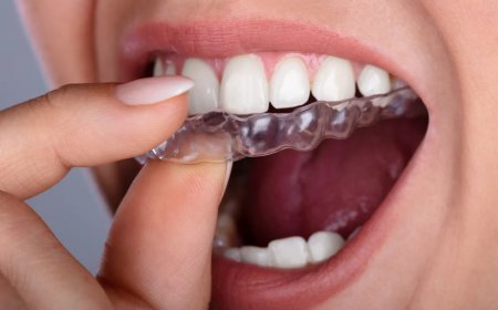 How Do Mouth Guards Help Protect Teeth?
