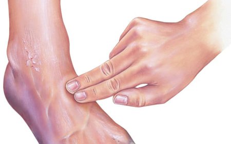 Peripheral Artery Disease (PAD) Market Growth and Future Outlook