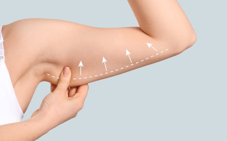 Who Is the Best Candidate for Arm Lift Surgery?
