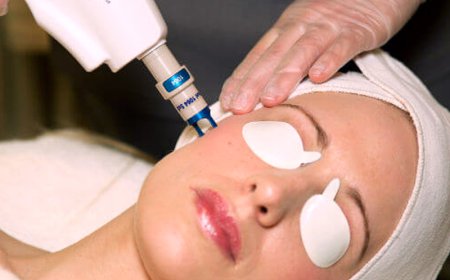 Is ClearLift Laser Effective for Younger-Looking Skin?