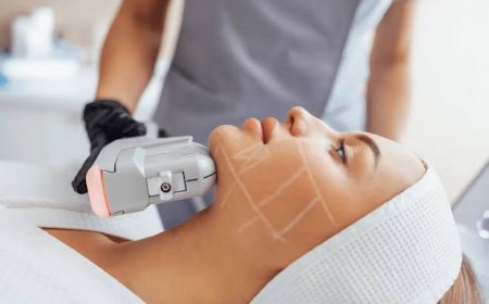 How HIFU Treatment Lifts and Firms Aging Skin