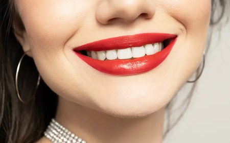How Is Hollywood Smile Design Performed?