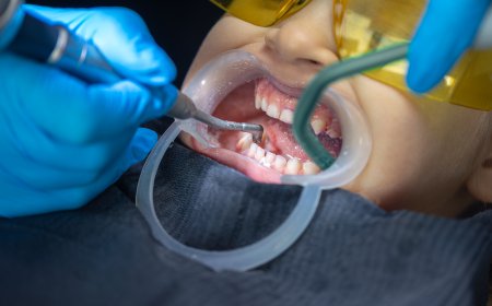 Wisdom Tooth Extraction Healing Stages Pictures: What to Expect Every Day