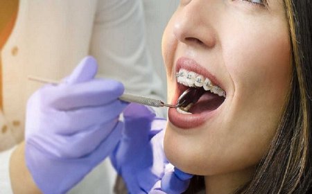 Walk-In Dentist Fort Worth | Dental Implants, Teeth Whitening & Dental Cleaning at Prestige Dental