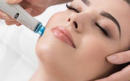 Does HydraFacial Reduce Fine Lines?