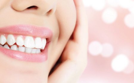 Hollywood Smile Design for Busy Professionals