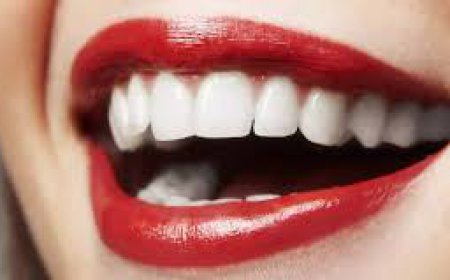 Can Hollywood Smile Design Enhance Your Appearance?