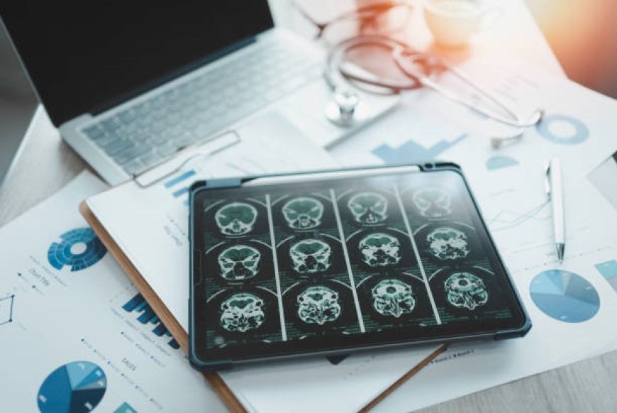 Brain Aneurysm Statistics in the United States Updated for 2026