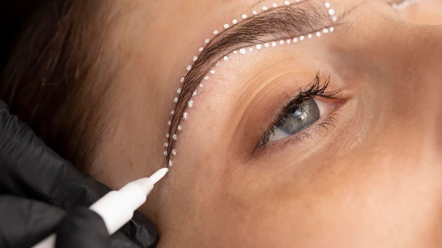 Is an Eyebrow Transplant Permanent?