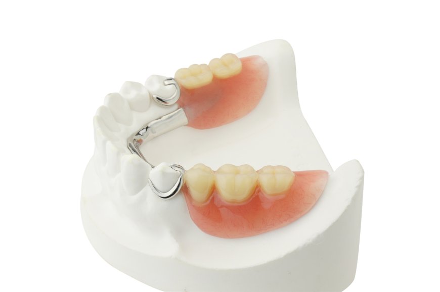 Who Can Benefit Most from Dentures?